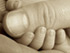 Birth Injuries in Colorado