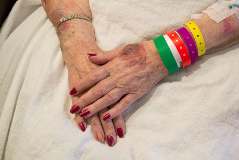 elderly with clear signs of bruising from abuse