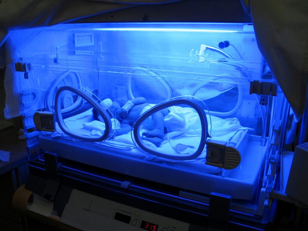 newborn baby under a UV lamp in incubator with a birth injury