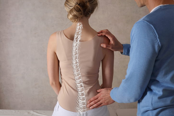 A graphic showing a curved spine inside a female patient.
